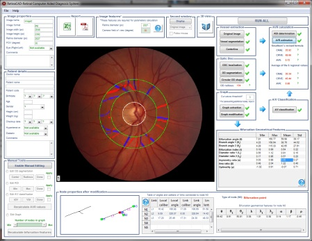 Retina CAD 