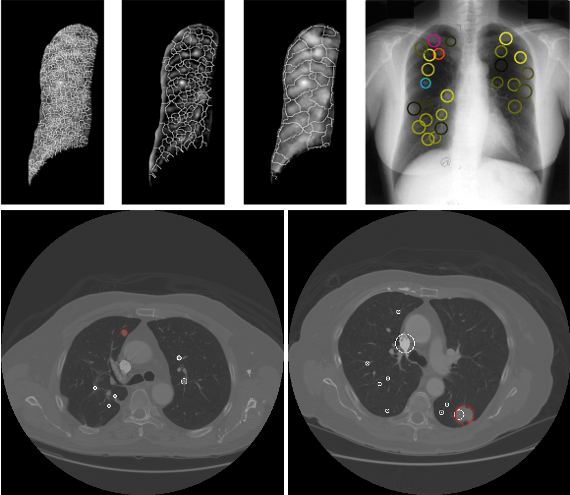 Lungs