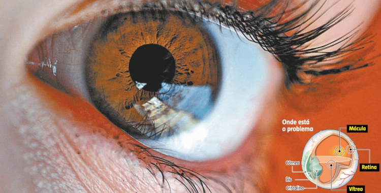 Plataforma para rastreio da retinopatia diabética em desenvolvimento no INESC TEC (Ver Portugal)