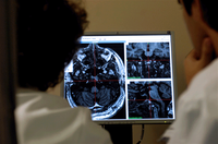 Sistema 3D ajuda doentes com epilepsia