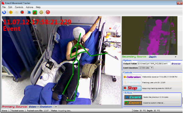 1º sistema de vídeo-3D do mundo para ajudar doentes epiléticos criado no INESC TEC