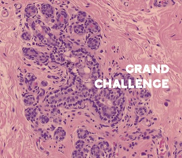 INESC TEC conquista 2º lugar no Grand Challenge in Digital Pathology 