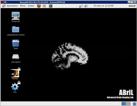 ABrIL – Laboratório de Imagens Neurológicas