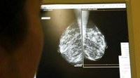 Investigadores portugueses criam software para diagnosticar cancro da mama e da próstata (Comunidade Azul)
