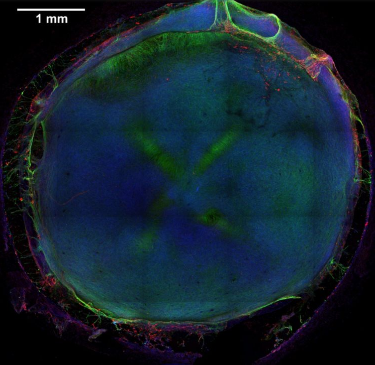 Micro-cérebros artificiais serviram para testar substâncias neurotóxicas