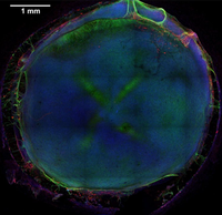 Micro-cérebros artificiais serviram para testar substâncias neurotóxicas